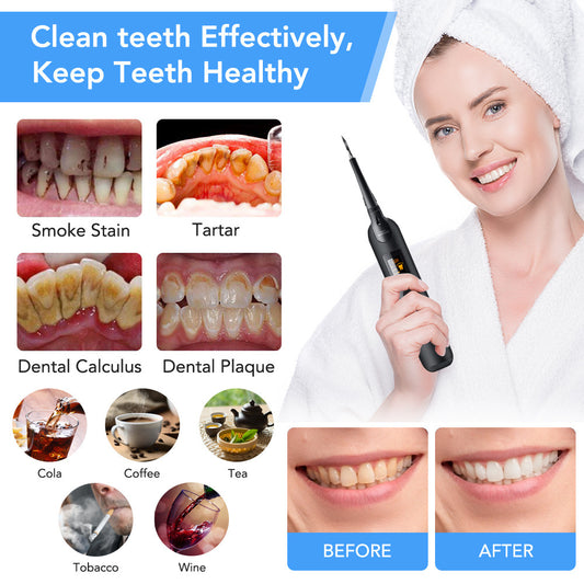 منظف ​​الأسنان الكهربائي المحمول، أداة العناية بالأسنان، منظف الأسنان